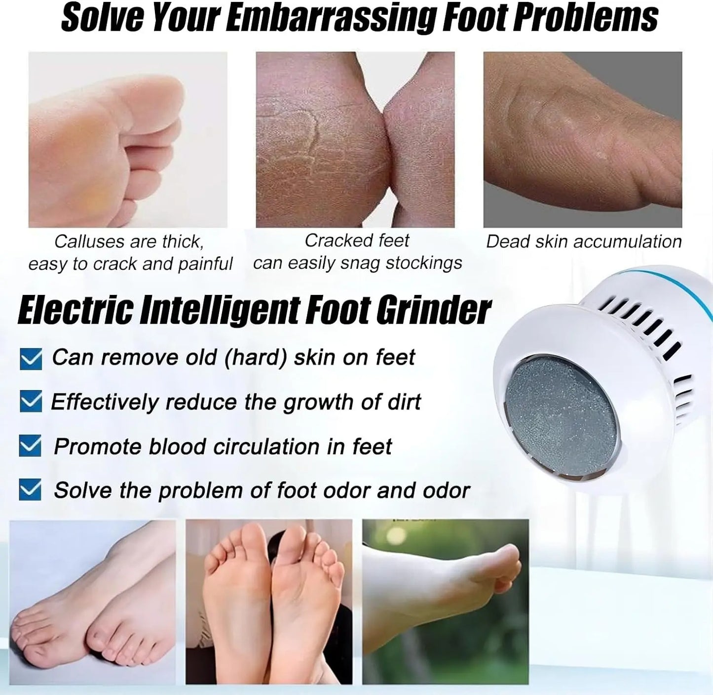 Electric Foot Callus Remover